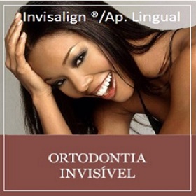 Ortodontia Invisível Invisalign ®