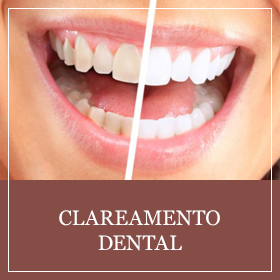 Clareamento Dental